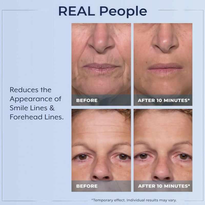 Plexaderm Rapid Reduction Eye Serum - Visibly Reduces Under-Eye Bags, Wrinkles, Dark Circles, Fine Lines & Crow's Feet Instantly, Anti Aging Wrinkle Remover for Face, Full Size Tube