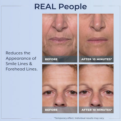 Plexaderm Rapid Reduction Eye Serum - Visibly Reduces Under-Eye Bags, Wrinkles, Dark Circles, Fine Lines & Crow's Feet Instantly, Anti Aging Wrinkle Remover for Face, Full Size Tube